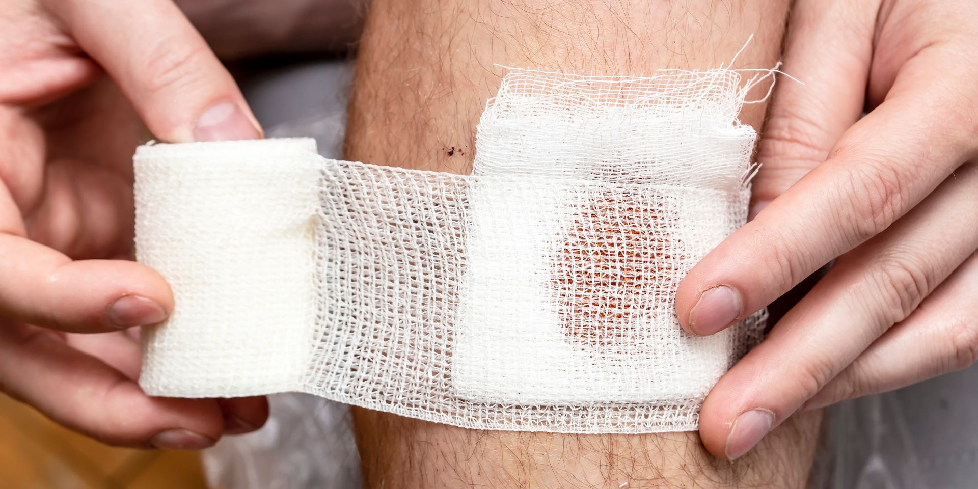 man bandaging a bleeding wound on his leg